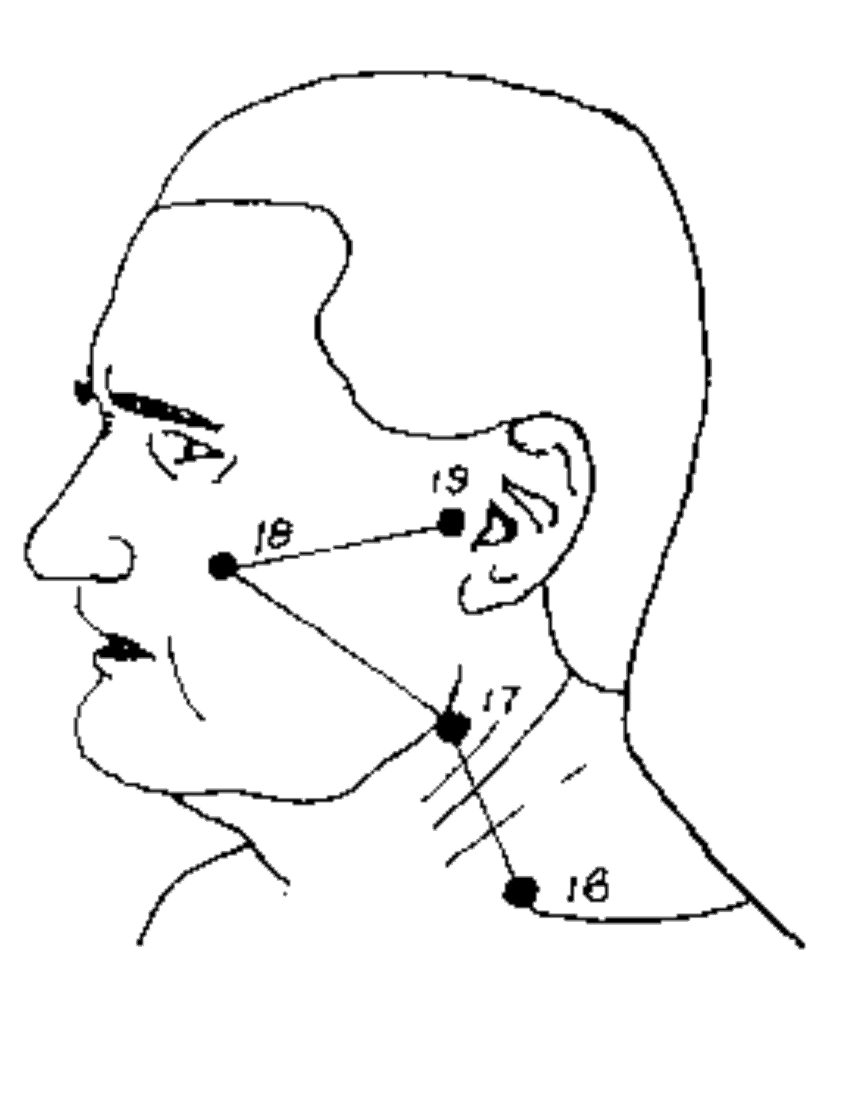 * SI-18 Most Painful Face Pressure Points