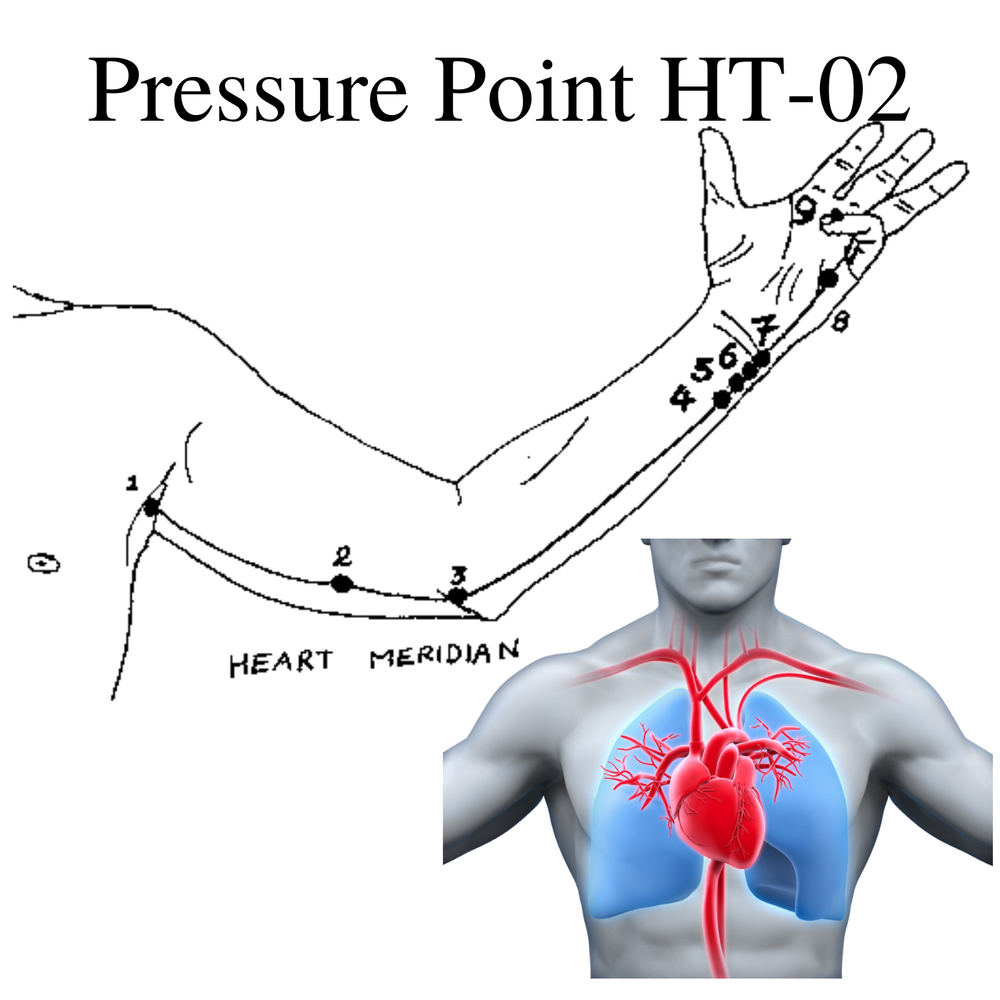 Pressure Point HT-02. What it takes to stop a heart